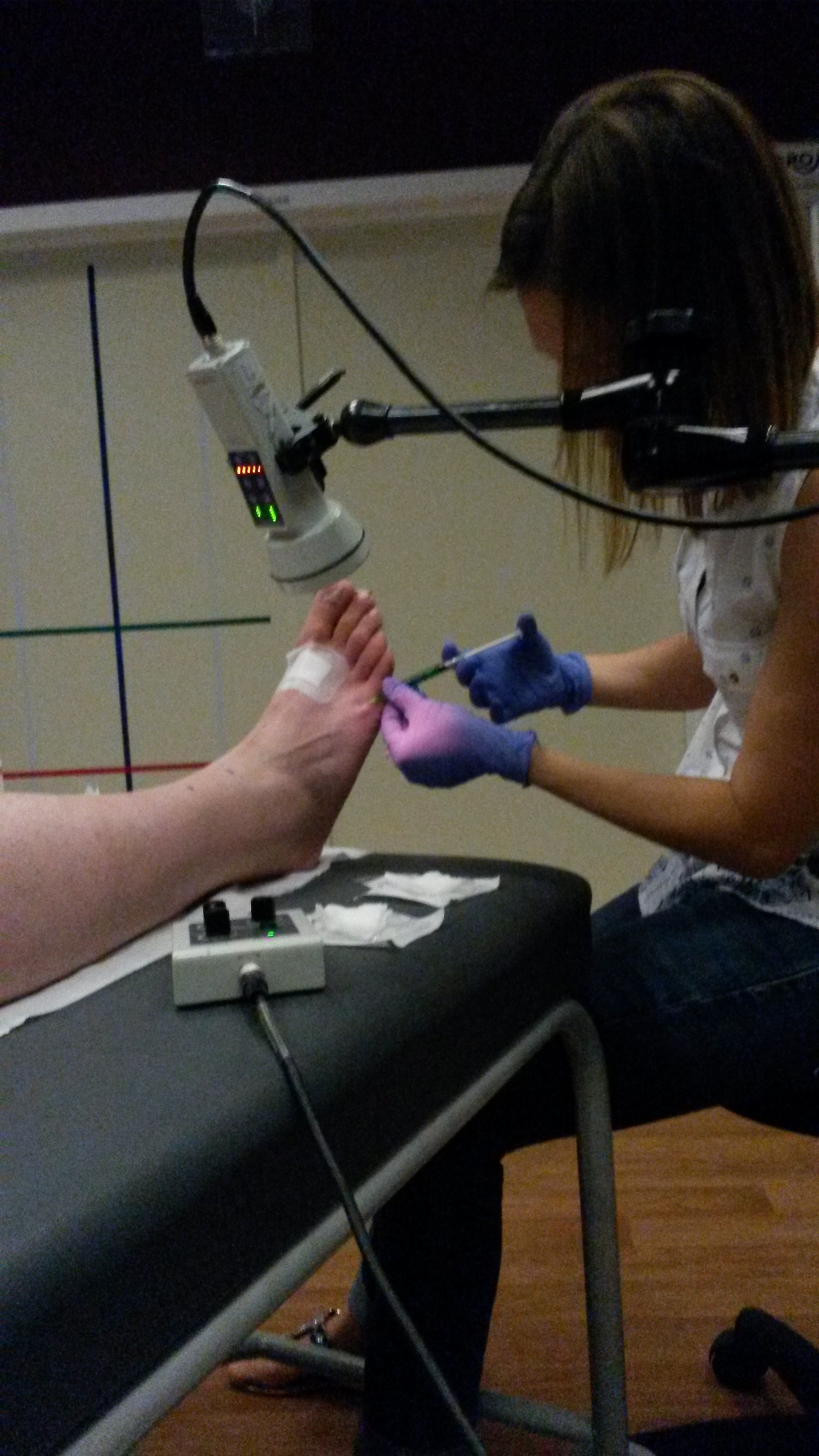 Injektion des Farbstoffs Indocyaningrün 20150811 103506